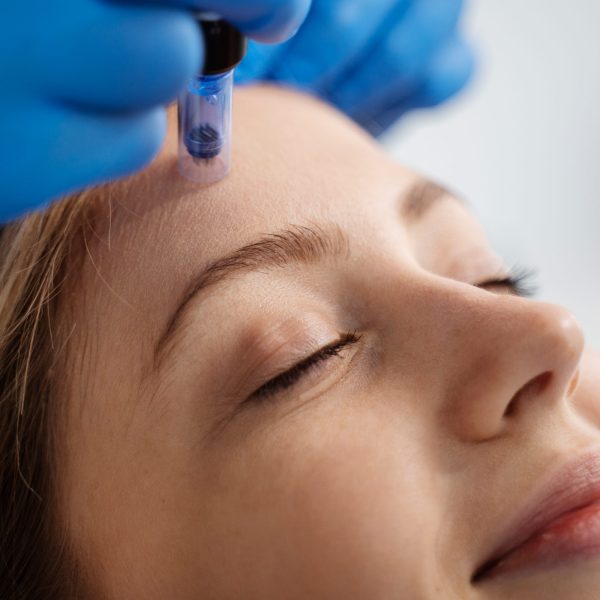 DERMAPEN - mezoterapia mikroigłowa